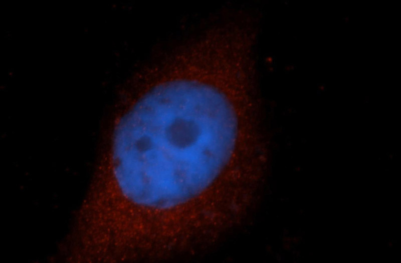 Immunofluorescent analysis of MCF-7 cells, using HMBS antibody Catalog No:111473 at 1:50 dilution and Rhodamine-labeled goat anti-rabbit IgG (red). Blue pseudocolor = DAPI (fluorescent DNA dye).