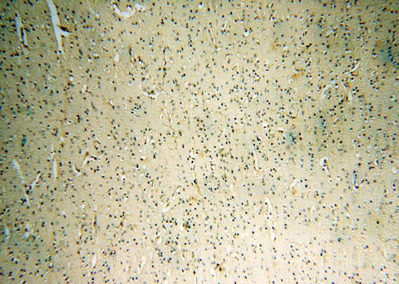 Immunohistochemical of paraffin-embedded human brain using Catalog No:113618(PC5 antibody) at dilution of 1:200 (under 10x lens)
