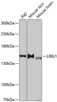 Western blot - LRIG1 Polyclonal Antibody 