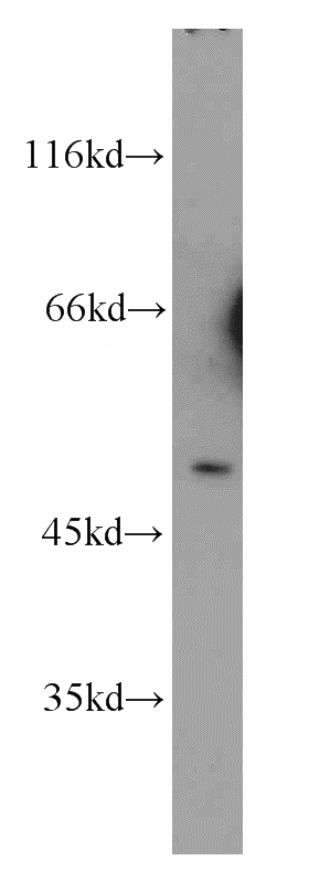 Raji cells were subjected to SDS PAGE followed by western blot with Catalog No:109278(CHRNA10 antibody) at dilution of 1:300