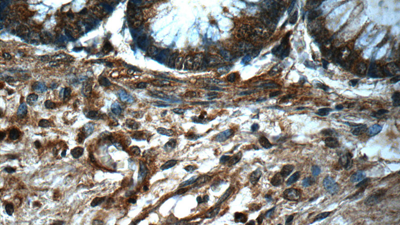 Immunohistochemistry of paraffin-embedded human colon slide using Catalog No:107482(PRDX4 Antibody) at dilution of 1:50(under 40x lens)
