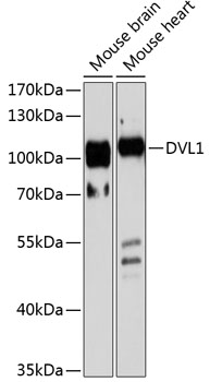 Western blot - DVL1 Polyclonal Antibody 
