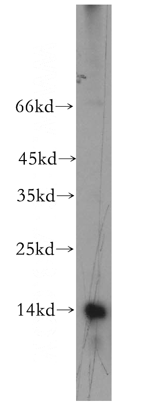 mouse liver tissue were subjected to SDS PAGE followed by western blot with Catalog No:110534(FAU antibody) at dilution of 1:300