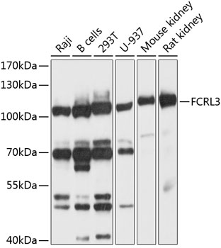 Western blot - FCRL3 Polyclonal Antibody 