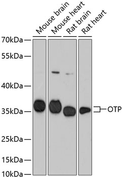 Western blot - OTP Polyclonal Antibody 