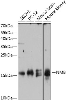 Western blot - NMB Polyclonal Antibody 