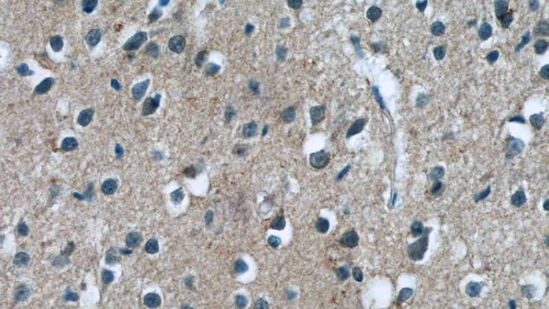 Immunohistochemistry of paraffin-embedded human brain tissue slide using Catalog No:112597(MGC39372 Antibody) at dilution of 1:50 (under 40x lens)