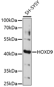 Western blot - HOXD9 Polyclonal Antibody 