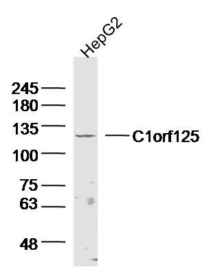 Fig2: Sample:; HepG2 Cell (Human) Lysate at 30 ug; Primary: Anti- C1orf125 at 1/300 dilution; Secondary: IRDye800CW Goat Anti-Rabbit IgG at 1/20000 dilution; Predicted band size: 118kD; Observed band size: 118kD