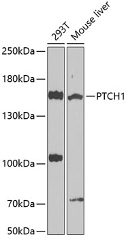 Western blot - PTCH1 Polyclonal Antibody 