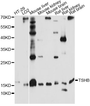 Western blot - TSHB Polyclonal Antibody 