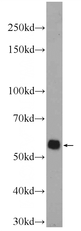 Jurkat cells were subjected to SDS PAGE followed by western blot with Catalog No:114714(RIPK3 Antibody) at dilution of 1:300