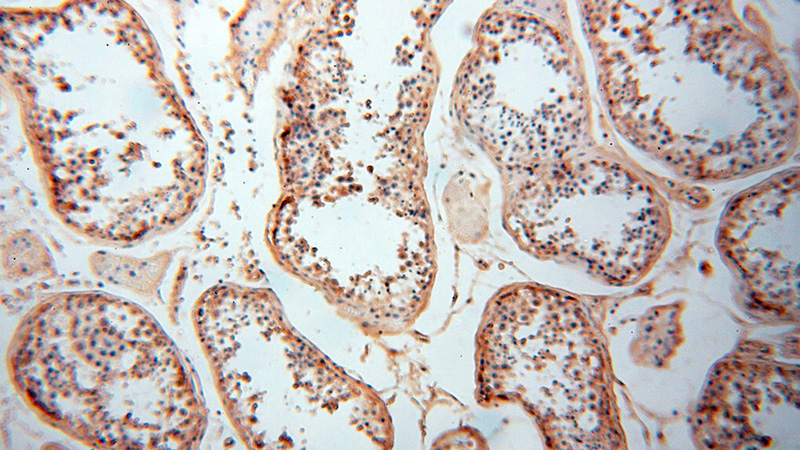 Immunohistochemical of paraffin-embedded human testis using Catalog No:109601(CSNK1A1L antibody) at dilution of 1:100 (under 10x lens)