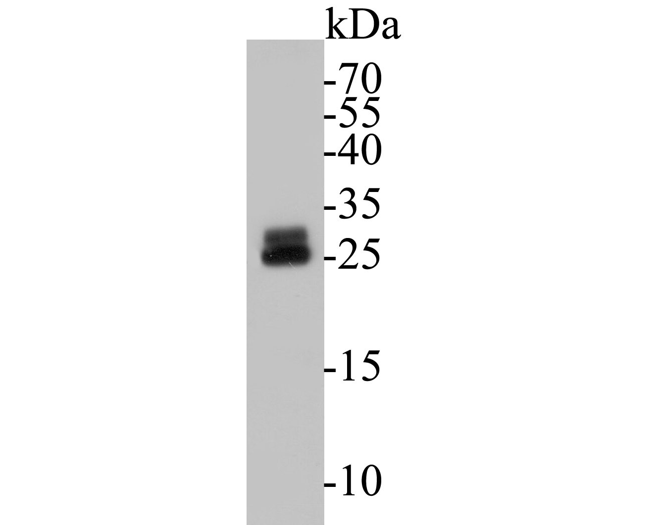 Fig1: Western blot analysis of RBPMS on mouse lung tissue lysates. Proteins were transferred to a PVDF membrane and blocked with 5% BSA in PBS for 1 hour at room temperature. The primary antibody ( 1/500) was used in 5% BSA at room temperature for 2 hours. Goat Anti-Rabbit IgG - HRP Secondary Antibody (HA1001) at 1:5,000 dilution was used for 1 hour at room temperature.
