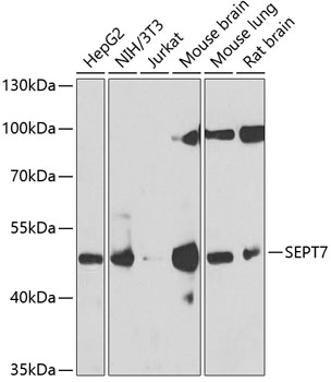 Western blot - SEPT7 Polyclonal Antibody 