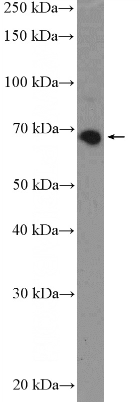 mouse skeletal muscle tissue were subjected to SDS PAGE followed by western blot with Catalog No:111921(KBTBD5 Antibody) at dilution of 1:300