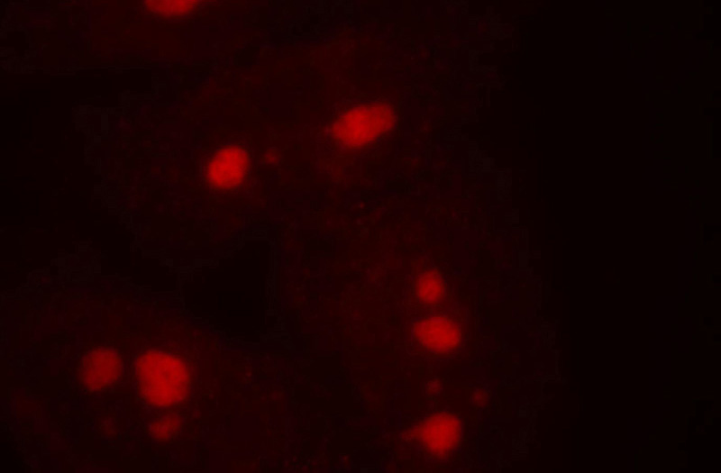 Immunofluorescent analysis of HepG2 cells, using UTP3 antibody Catalog No:116697 at 1:50dilution and Rhodamine-labeled goat anti-rabbit IgG (red).