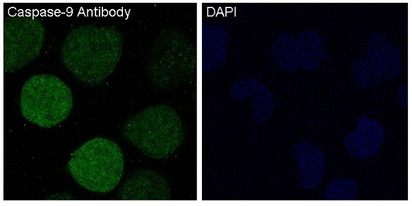 Immunofluorescent analysis of HeLa cells treated with staurosporine, using Caspase-9 Antibody.