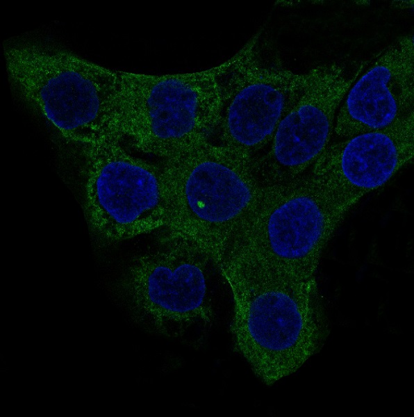 Immunofluorescent analysis of A431 cells, using alpha smooth muscle Actin Antibody .