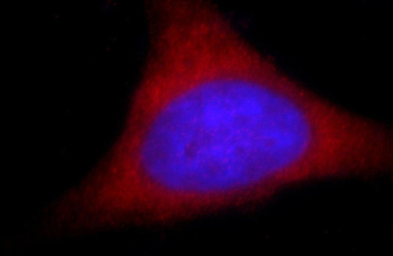 Immunofluorescent analysis of Hela cells, using KIFC1 antibody Catalog No:112053 at 1:25 dilution and Rhodamine-labeled goat anti-rabbit IgG (red). Blue pseudocolor = DAPI (fluorescent DNA dye).