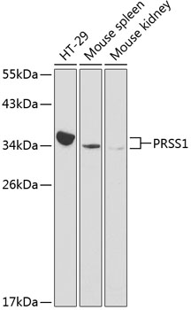 Western blot - PRSS1 Polyclonal Antibody 