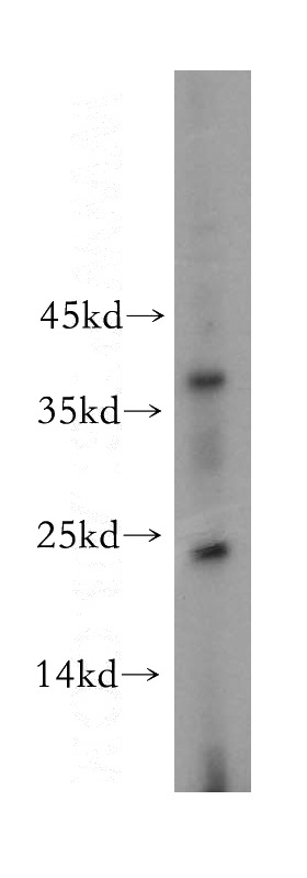 SH-SY5Y cells were subjected to SDS PAGE followed by western blot with Catalog No:109324(CITED2 antibody) at dilution of 1:400