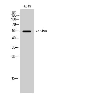 Fig1:; Western Blot analysis of A549 cells using ZNF498 Polyclonal Antibody. Secondary antibody（catalog#：HA1001) was diluted at 1:20000 cells nucleus extracted by Minute TM Cytoplasmic and Nuclear Fractionation kit (SC-003,Inventbiotech,MN,USA).