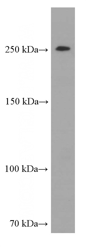 HEK-293 cells were subjected to SDS PAGE followed by western blot with (CHD4 Antibody) at dilution of 1:500
