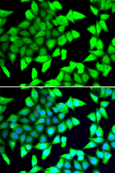 Immunofluorescence - HDAC5 Polyclonal Antibody 