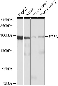 Western blot - EIF3A Polyclonal Antibody 