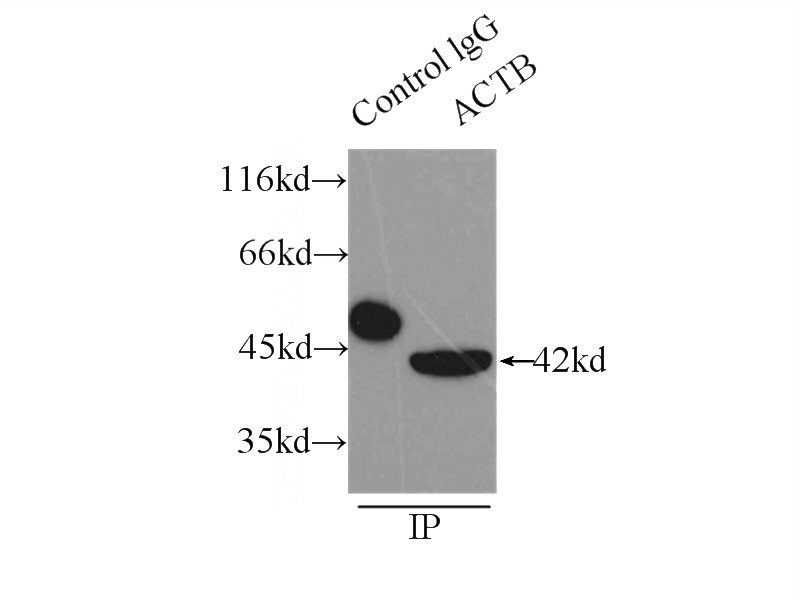 IP Result of anti-beta actin (IP:Catalog No:117302, 3ug; Detection:Catalog No:117302 1:10000) with HeLa cells lysate 3100ug.