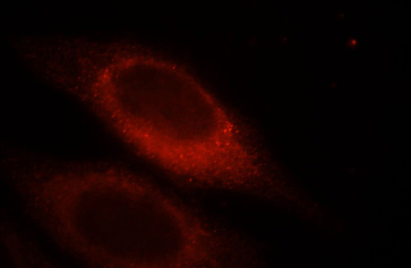 Immunofluorescent analysis of HepG2 cells, using MYLK antibody Catalog No:112972 at 1:25 dilution and Rhodamine-labeled goat anti-rabbit IgG (red).