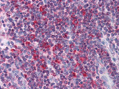 Immunohistochemical analysis of paraffin-embedded human Liver tissues using Metadherin mouse mAb