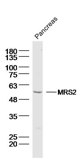 Fig1: Sample: Pancreas (mouse) Lysate at 40 ug; Primary: Anti- MRS2 at 1/300 dilution; Secondary: IRDye800CW Goat Anti-Rabbit IgG at 1/20000 dilution; Predicted band size: 50kD; Observed band size: 50 kD
