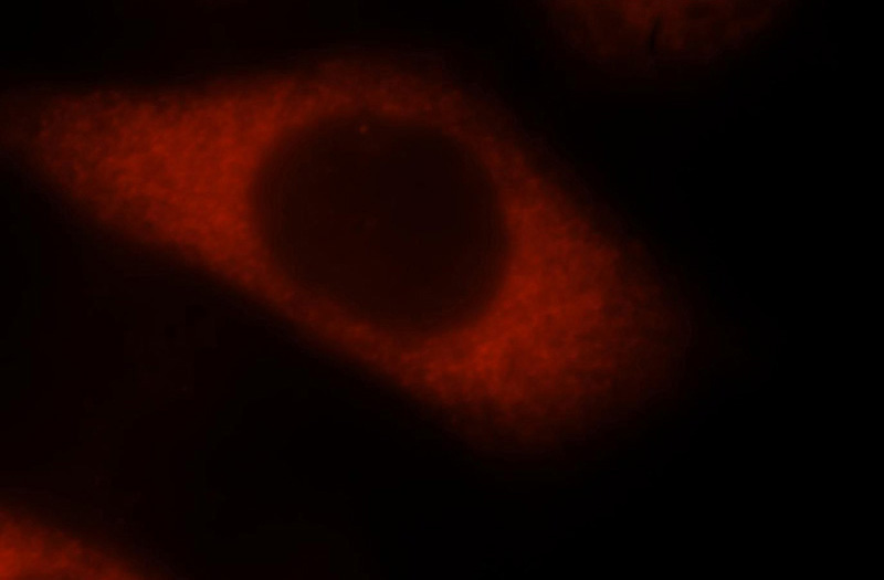 Immunofluorescent analysis of MCF-7 cells, using Catalog No:110313 and Rhodamine-labeled goat anti-rabbit IgG (red).