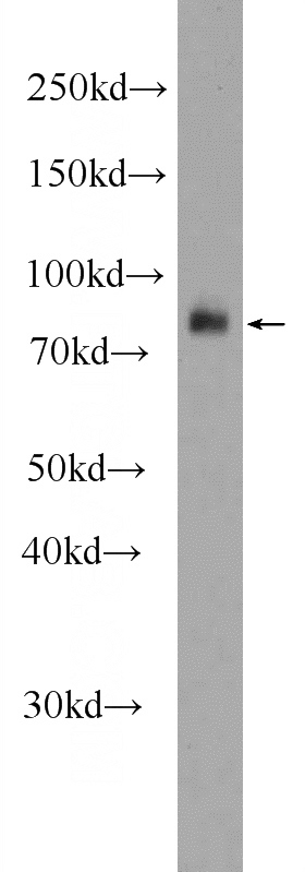 mouse kidney tissue were subjected to SDS PAGE followed by western blot with Catalog No:112655(MEP1A Antibody) at dilution of 1:1000