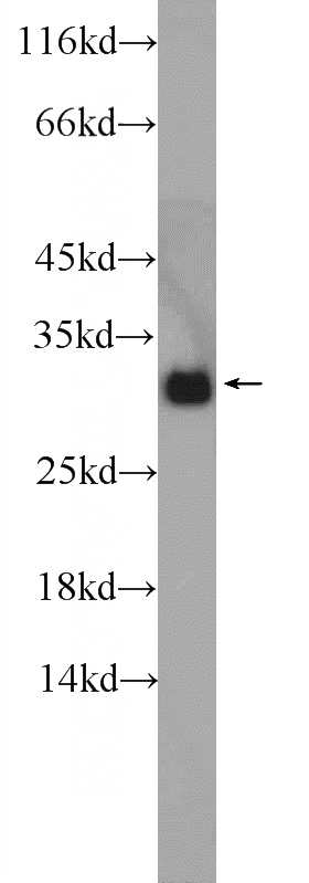 human brain tissue were subjected to SDS PAGE followed by western blot with Catalog No:111012(GNRHR2 antibody) at dilution of 1:500