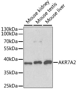 Western blot - AKR7A2 Polyclonal Antibody 