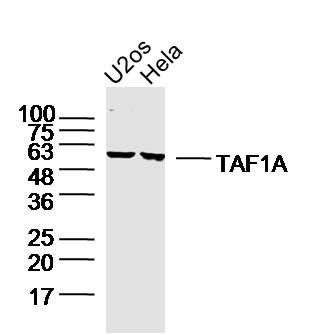 Fig1: Sample:; U2OS Cell Lysate at 40 ug; Hela Cell Lysate at 40 ug; Primary: Anti-TAF1A at 1/300 dilution; Secondary: IRDye800CW Goat Anti-Rabbit IgG at 1/20000 dilution; Predicted band size: 53 kD; Observed band size: 53 kD