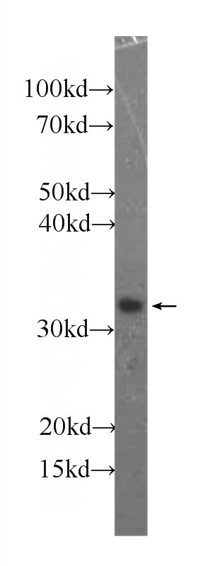 human heart tissue were subjected to SDS PAGE followed by western blot with Catalog No:107057(Annexin IV Antibody) at dilution of 1:1000