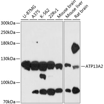 Western blot - ATP13A2 Polyclonal Antibody 