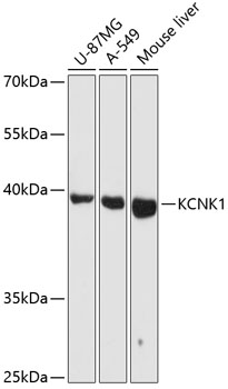 Western blot - KCNK1 Polyclonal Antibody 