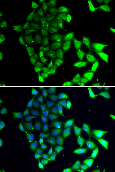 Immunofluorescence - MID1 Polyclonal Antibody 