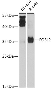 Western blot - FOSL2 Polyclonal Antibody 