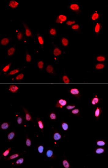 Immunofluorescence - RAD18 Polyclonal Antibody 