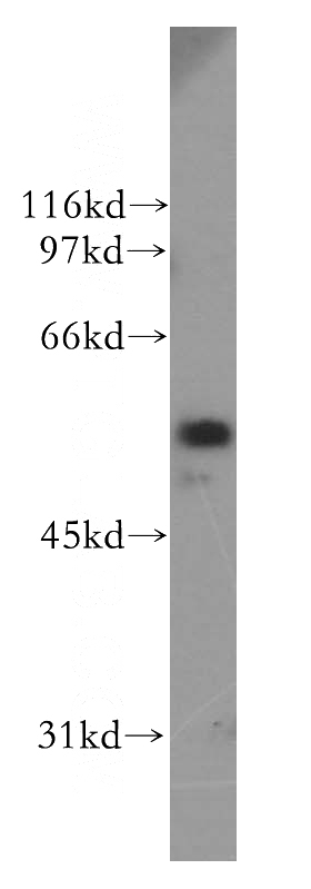 PC-3 cells were subjected to SDS PAGE followed by western blot with Catalog No:109711(CYP51A1 antibody) at dilution of 1:1000