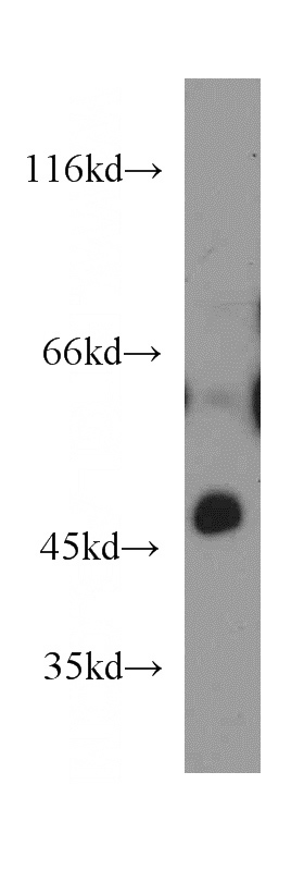 mouse spleen tissue were subjected to SDS PAGE followed by western blot with Catalog No:111470(HS3ST1 antibody) at dilution of 1:500