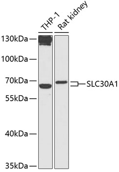 Western blot - SLC30A1 Polyclonal Antibody 