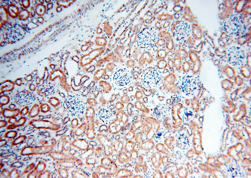 Immunohistochemical of paraffin-embedded human kidney using Catalog No:108569(BPHL antibody) at dilution of 1:100 (under 10x lens)
