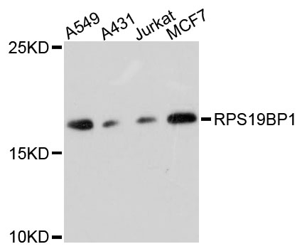 Western blot - RPS19BP1 Polyclonal Antibody 